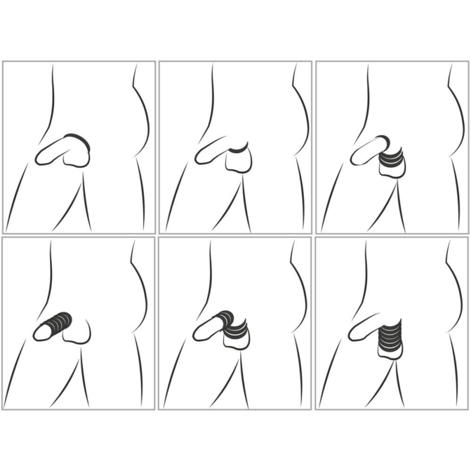 You 2 Toys-Cock & Ball Stretching Kit